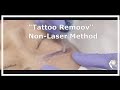 Eyebrow Tattoo Removal Non Laser
