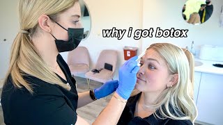 I GOT BOTOX TREATMENT FOR THE FIRST TIME *being transparent, migraines & why i decided to do it*