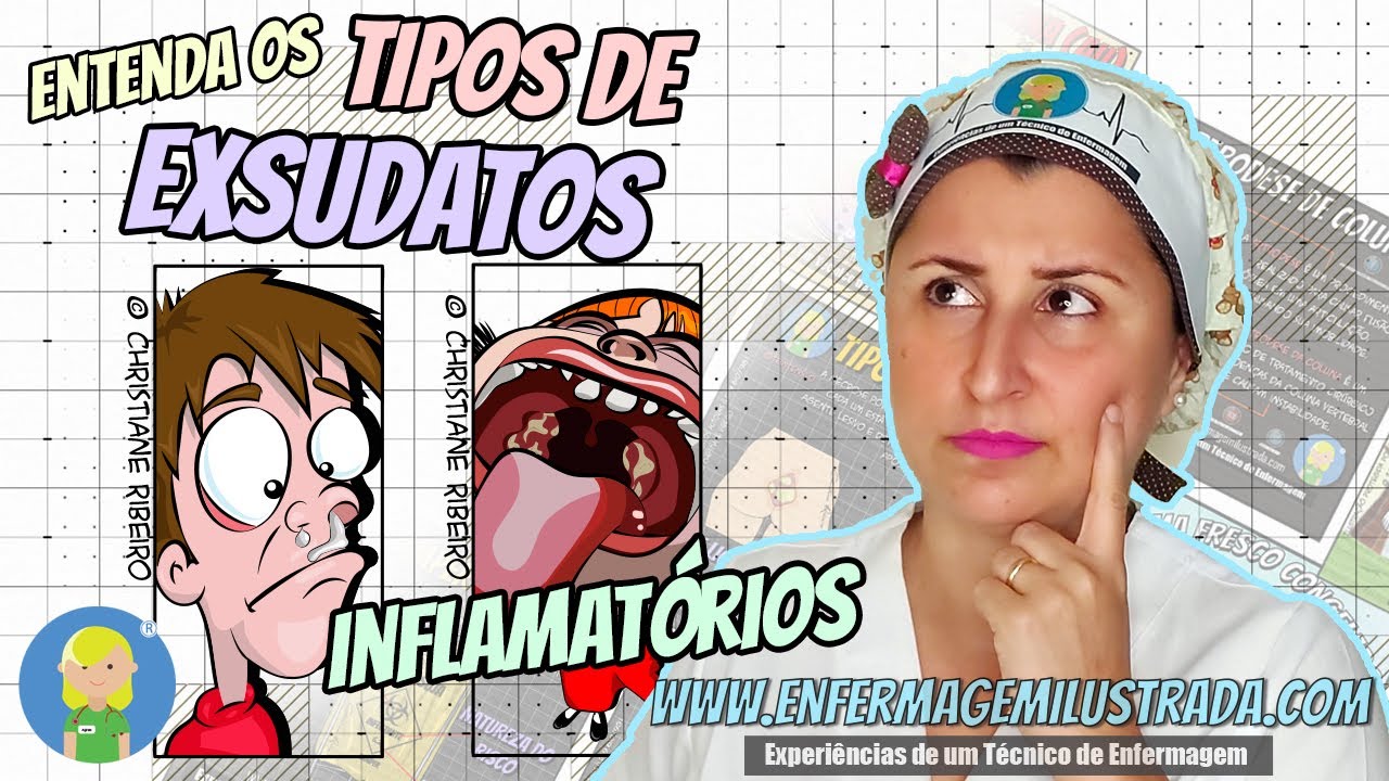 Entenda sobre os tipos de EXSUDATOS INFLAMATÓRIOS agora mesmo!