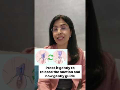 Is your menstrual cup stuck? Here’s how you can get it out!