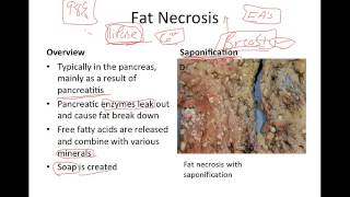 Pathophysiology: Cellular Death
