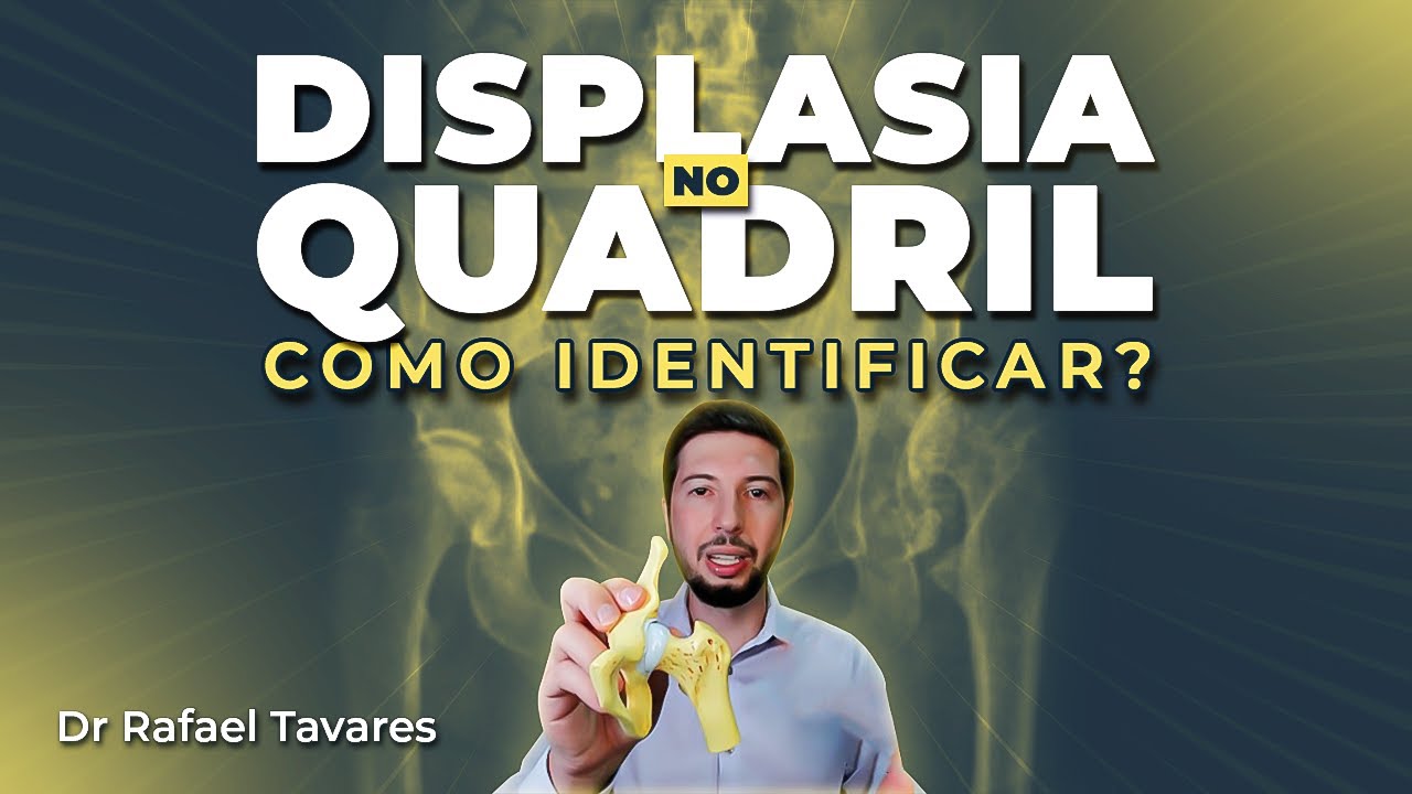 Displasia no Quadril - Como sei se eu tenho? | Dr Rafael Tavares - Quadril