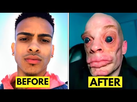 12 PEOPLE Who Regretted Changing Their Race With Surgery