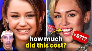 How much do celebrity smiles cost? (Dentist explains)