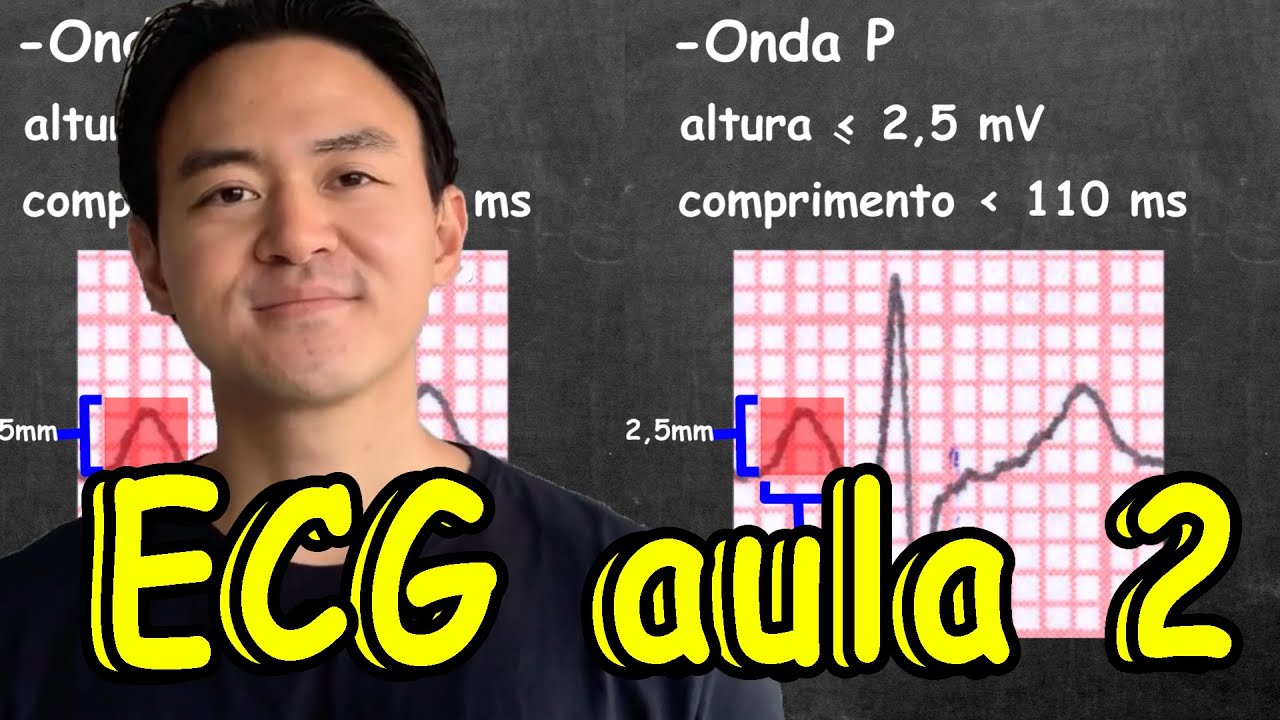 ECG aula 2