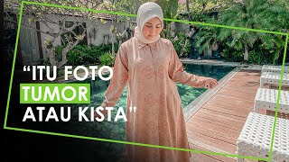 Dituding Pamerkan Foto USG Janin, Kesha Ratuliu : Itu Tumor atau Kista