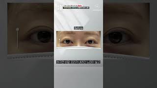 청담i성형외과의원
