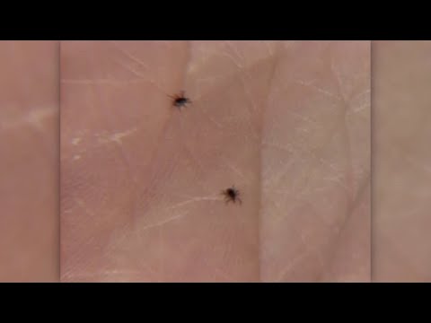 NY Rockland County Tick Warning