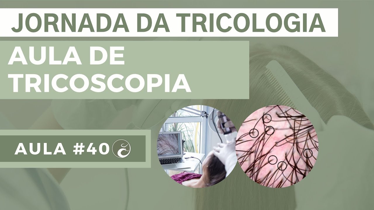 JORNADA DA TRICOLOGIA - Aula 40| DIAGNÓSTICO DE ALOPECIA ANDROGENÉTICA