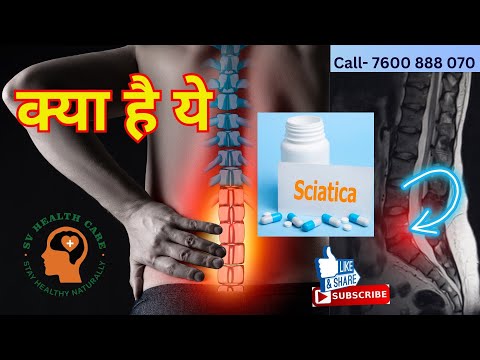 sciatica pain results