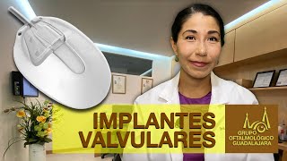 Cirugía de implante de válvula para glaucoma