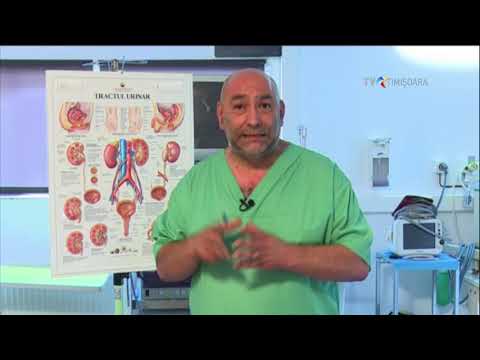 Metode de tratament pentru artroza de gradul II