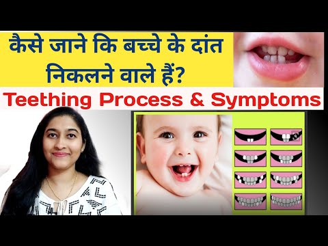 कैसे जाने कि बच्चों के दांत निकलने वाले हैं?| Teething Signs & Symptoms in babies| Indian Moms World