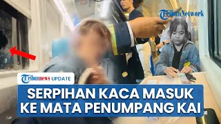 Nasib Penumpang KAI yang Terkena Serpihan Kaca karena Dilempar Batu, Dapat Kompensasi Perawatan Mata