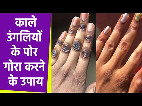 काली उंगलियों के पोर गोरा करने के उपाय । Kali Ungliyo ke Por Gora Karne ke Upay । Boldsky *Health