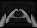 Zara larsson - lush life (sped up) Zara larsson - lush life (sped up)