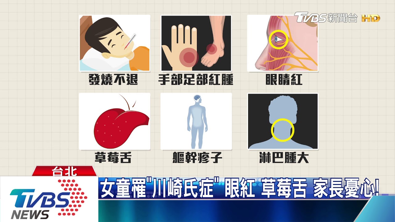 女童罹「川崎氏症」 眼紅 草莓舌 家長憂心!