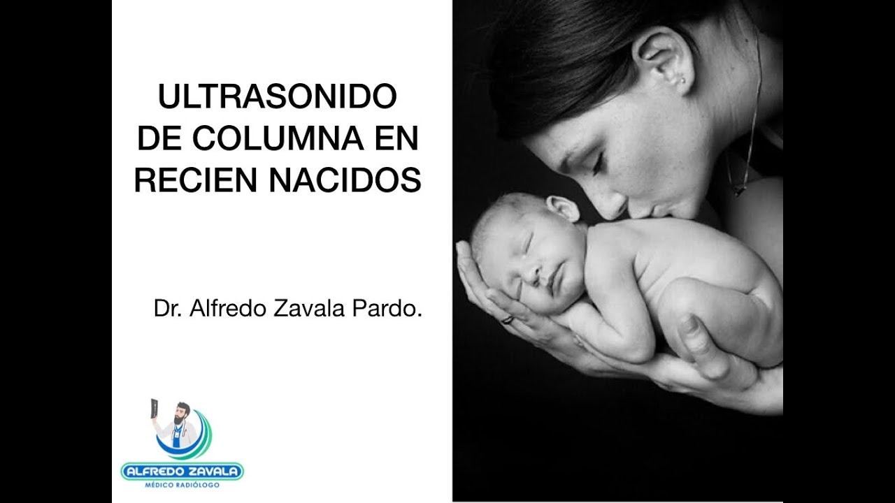 Alfredo Zavala Pardo-28