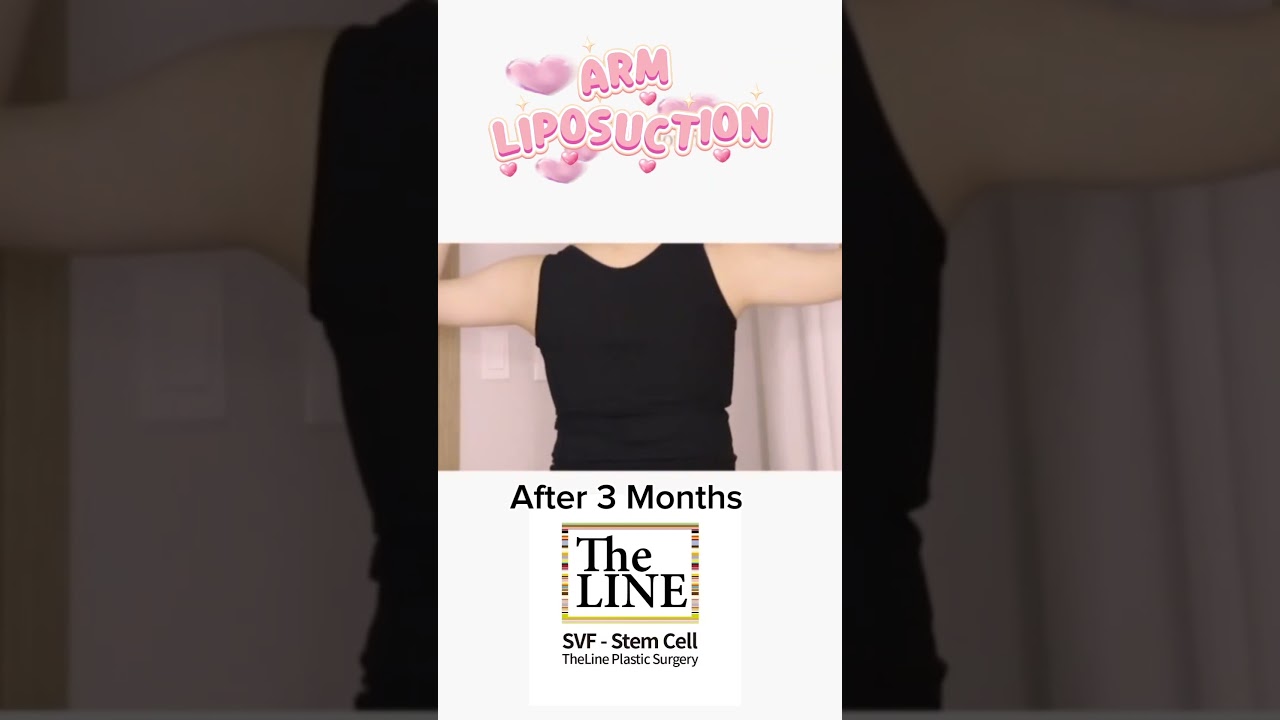 TheLINE shorts video