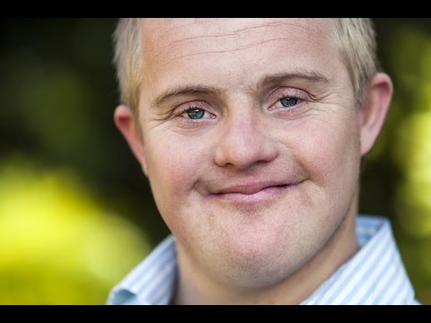 Down Syndrome (Trisomy 21)