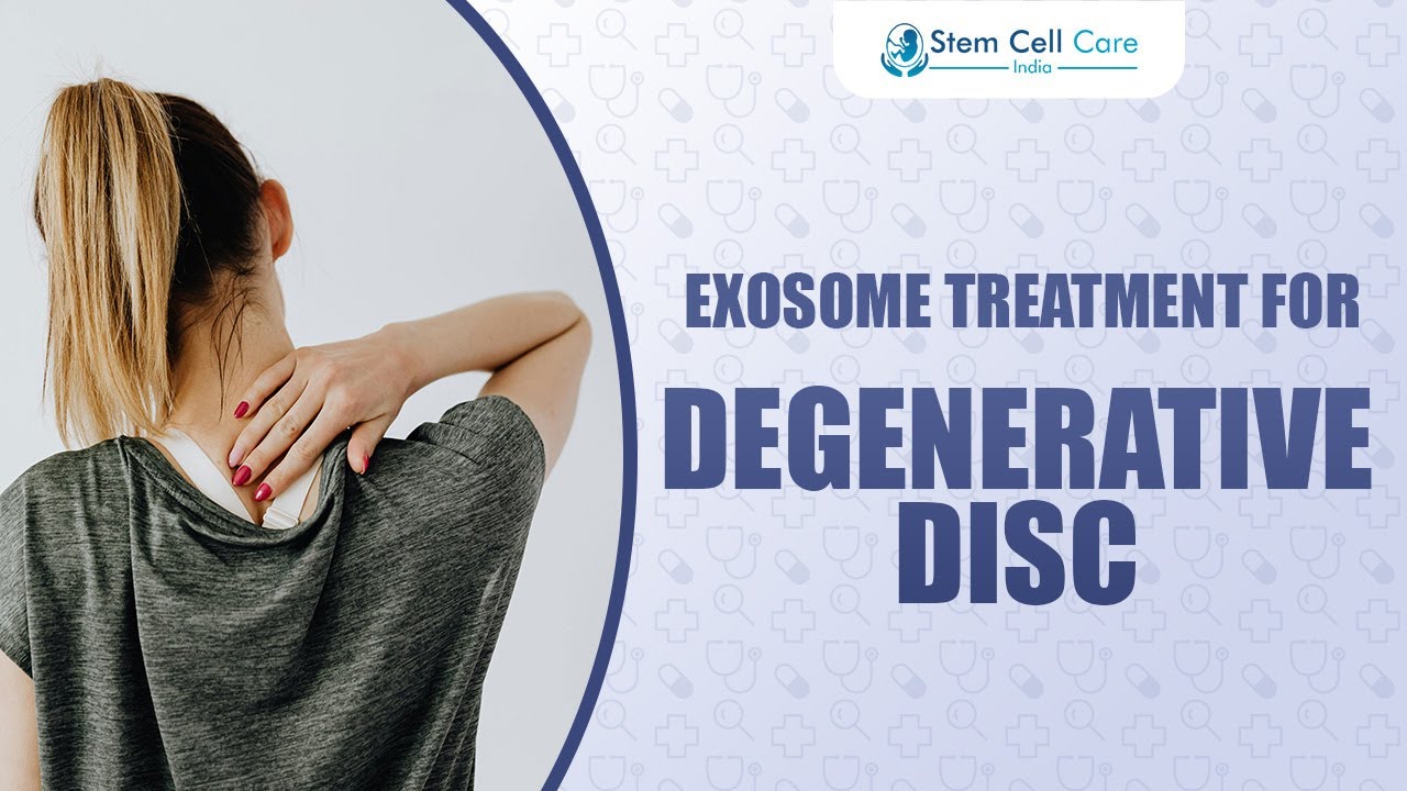 Exosome Therapy for Degenerative Disc Disease | Advanced Spine Treatment