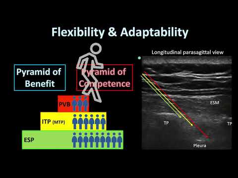 ESP Block - Where To Inject [2023]