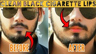 How To Get Rid Of Dark (Black) lips at Home | Get Soft Pink Lips |