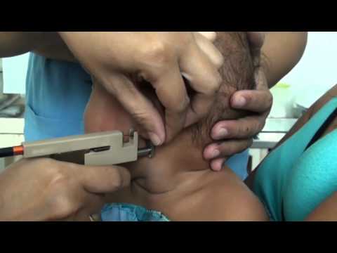 Dog mawalan ng timbang Video Manipis na yang Churikov