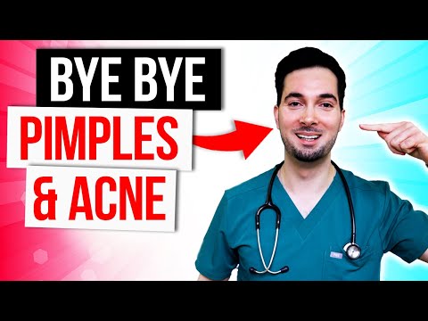 How To Get Rid Of Stretch Marks Removal and Treatment