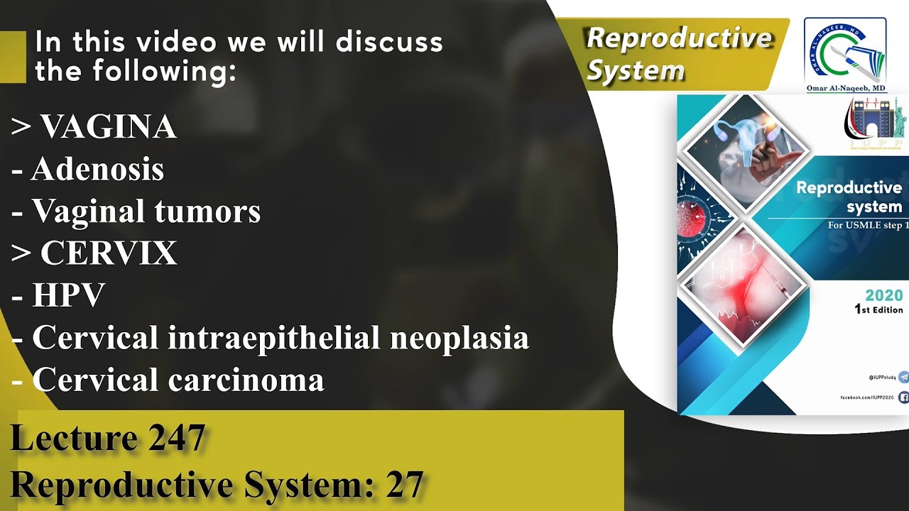 Adenosis | Vaginal tumors | HPV | Cervical intraepithelial neoplasia | Cervical carcinoma
