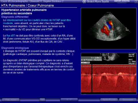Sang impression de table de pression Lhypertension et son application