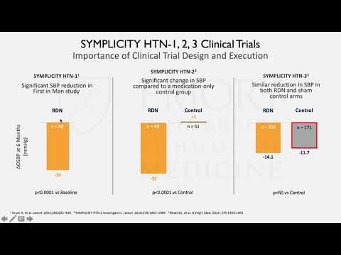 Renal Denervation for Hypertension: State of the Science in 2021