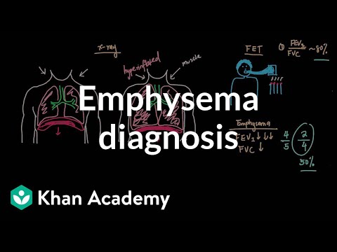 Emphysema diagnosis | Respiratory system diseases | NCLEX-RN | Khan Academy