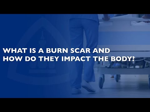 Burn Scar Treatment Q&A
