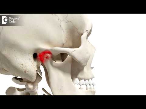 Jaw stuck open when yawning-What to do