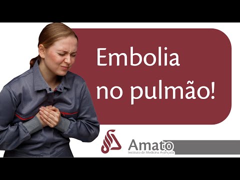 Everything You Need to Know About Pulmonary Embolism!