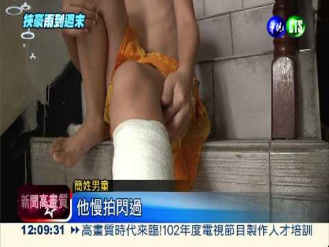 強風吹斷電線 2童閃不及遭燒傷