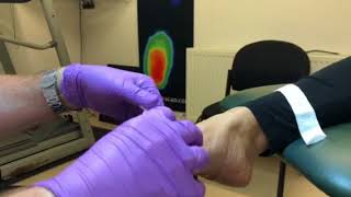 Walsh Podiatry Toe dressing