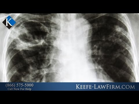 Does Asbestos Exposure Continue to Cause Mesothelioma?