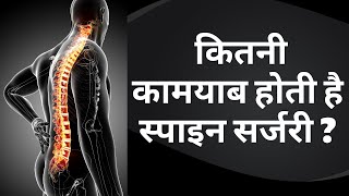 Download lagu Success Rate of Spine Surgery | How successful is spine surgery? | Dr Sahil Batra mp3