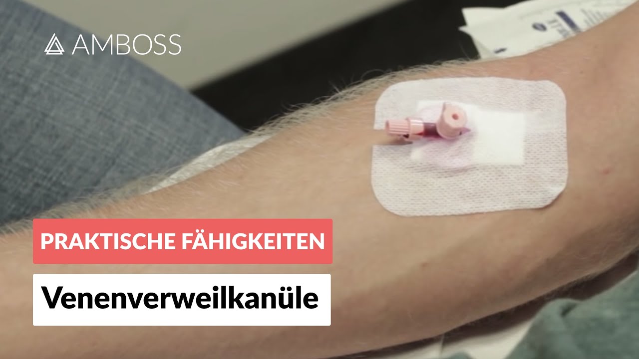 Legen einer Venenverweilkanüle (peripherer venöser Zugang, Viggo, Flexüle, Braunüle) - AMBOSS Video