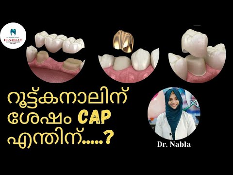 Dr. Nabla's Dental talk