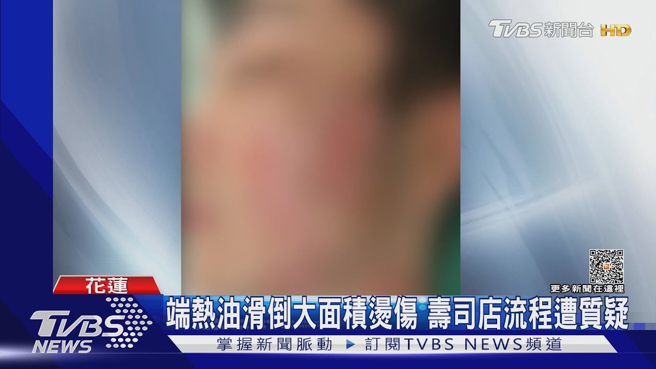 端熱油滑倒大面積燙傷!壽司店流程遭質疑