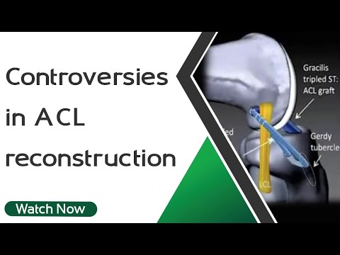 ACL Reconstruction