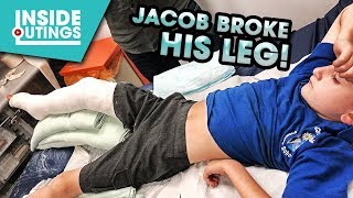 JACOB BROKE HIS LEG!