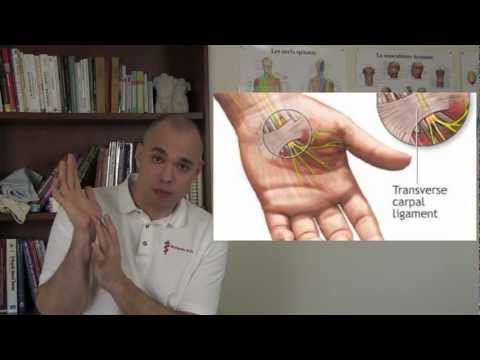 comment traiter syndrome canal carpien