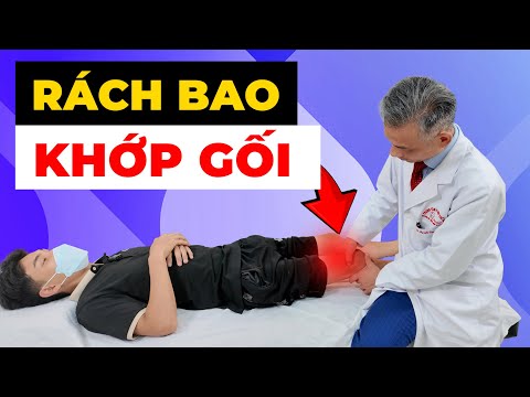 Rách Bao Khớp Gối: Đau Nhức Không Dám Đi Lại? Giải Pháp Điều Trị Hiệu Quả