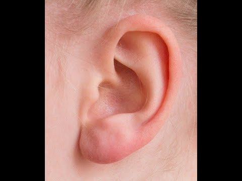 COMO SE DICE OREJA EN INGLÉS