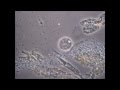 Микроорганизмы под микроскопом. Фазовый контраст КФ-5 