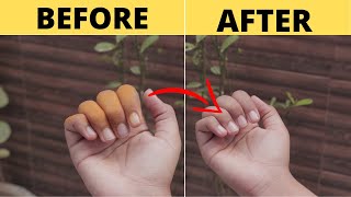 How to Remove Turmeric Stains from Hands & Nails DIY